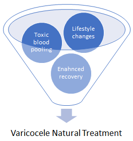 varicocele  natural treatments