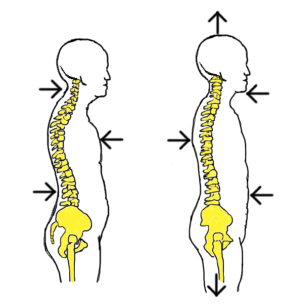 varicocele good posture axial extention