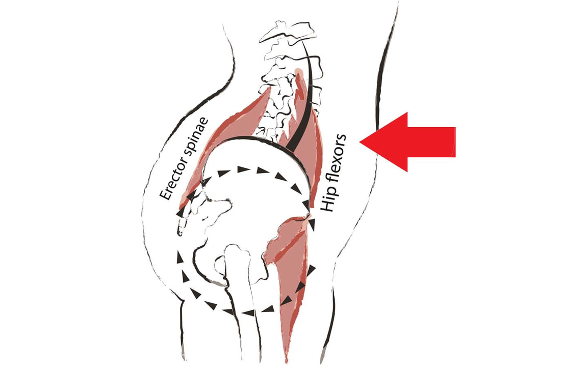nutcracker syndrome treatment: alleviate abdominal pressure