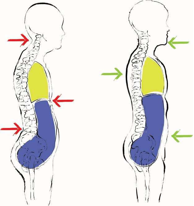 varicocele posture