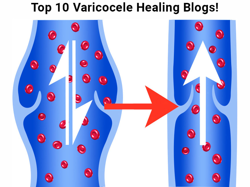 natural blogs for varicocele treatment - top 10 varicocele!